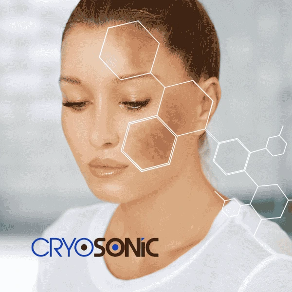Are you looking for age spot removal treatment? Contact Cryosonic today in Blackburn