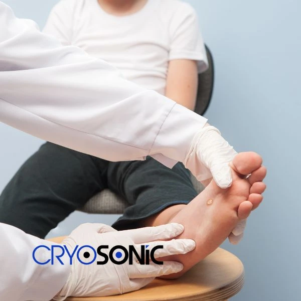 Are you looking for fast effective wart removal Contact us today Blackburn