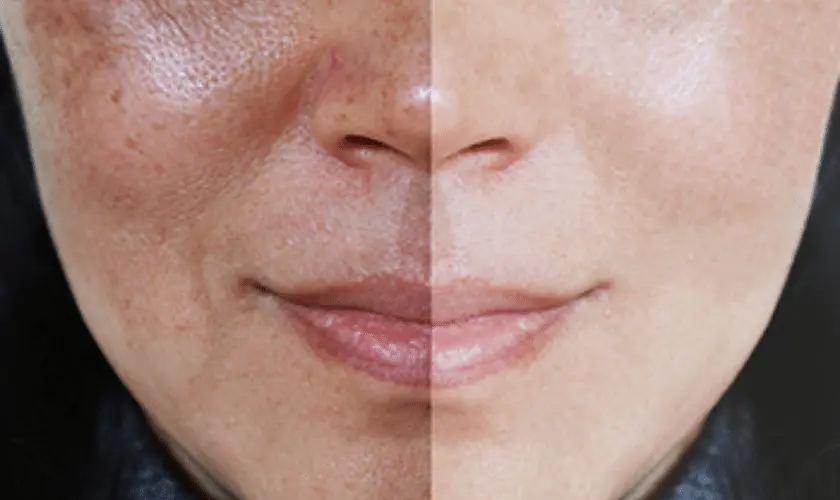 What Lifestyle Changes Support Skin Repair Blackburn? Blackburn